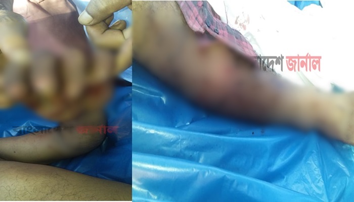 সিলেটে ফাঁড়িতে যুবকের মৃত্যু, কাঠগড়ায় পুলিশ