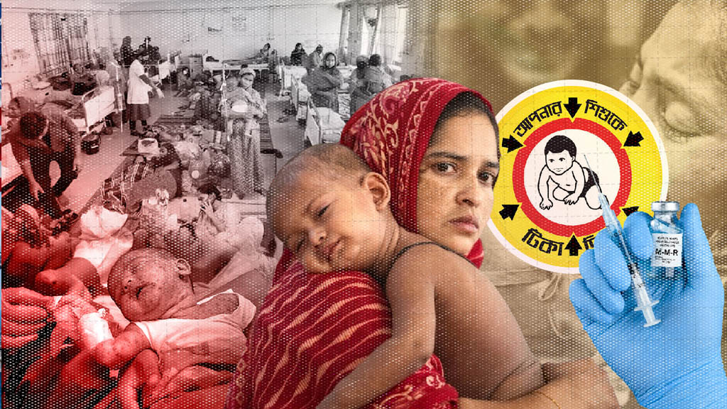 ২৪ ঘণ্টায় হামের উপসর্গে আরও ৫ মৃত্যু