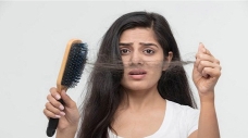 যে ভিটামিনের অভাবে হঠাৎ অতিরিক্ত চুল পড়ে যায়
