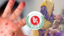 ফরিদপুরে হামের উপসর্গ নিয়ে আরও ২ শিশুর মৃত্যু, নতুন ভর্তি ৫৪